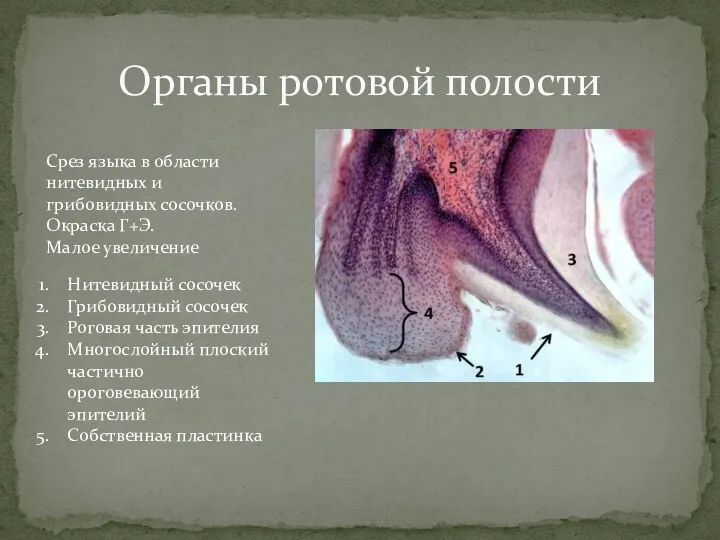 Органы ротовой полости Срез языка в области нитевидных и грибовидных сосочков. Окраска Г+Э.