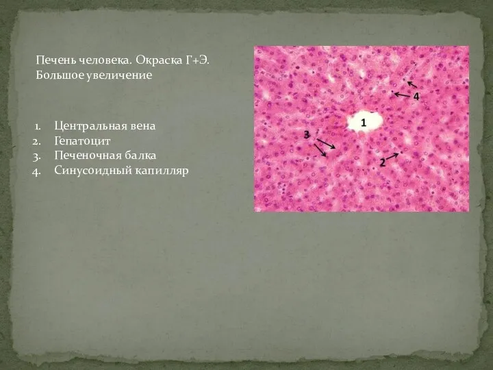 Печень человека. Окраска Г+Э. Большое увеличение Центральная вена Гепатоцит Печеночная балка Синусоидный капилляр