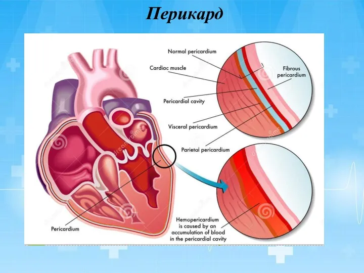 Перикард