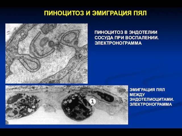 ПИНОЦИТОЗ И ЭМИГРАЦИЯ ПЯЛ ПИНОЦИТОЗ В ЭНДОТЕЛИИ СОСУДА ПРИ ВОСПАЛЕНИИ. ЭЛЕКТРОНОГРАММА ЭМИГРАЦИЯ ПЯЛ МЕЖДУ ЭНДОТЕЛИОЦИТАМИ. ЭЛЕКТРОНОГРАММА