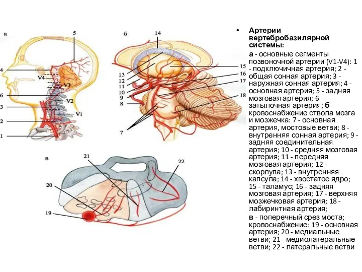Артерии вертебробазилярной системы: а - основные сегменты позвоночной артерии (V1-V4):