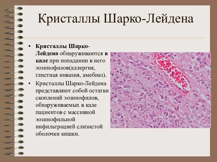 Кристаллы Шарко-Лейдена Кристаллы Шарко- Лейдена обнаруживаются в кале при попадании