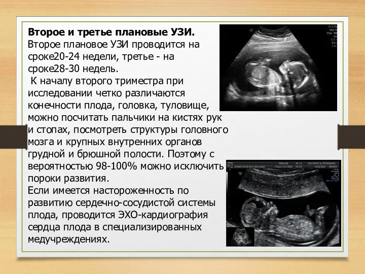 Второе и третье плановые УЗИ. Второе плановое УЗИ проводится на сроке20-24 недели, третье