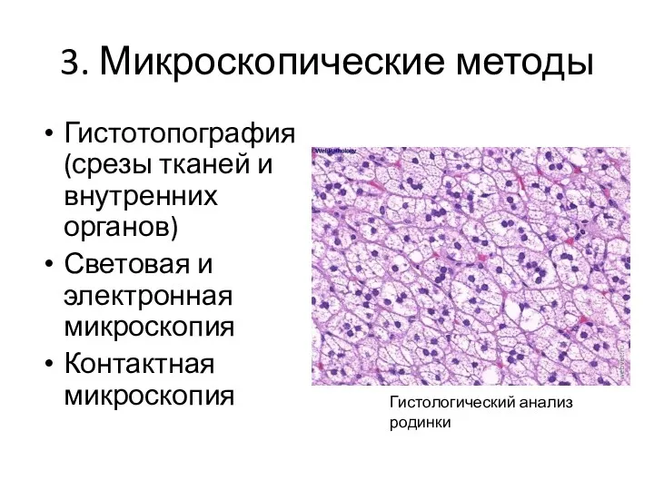 3. Микроскопические методы Гистотопография (срезы тканей и внутренних органов) Световая