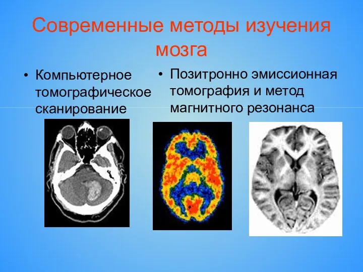 Современные методы изучения мозга Компьютерное томографическое сканирование Позитронно эмиссионная томография и метод магнитного резонанса
