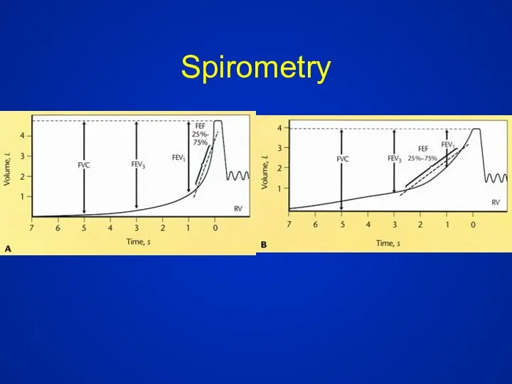 Spirometry