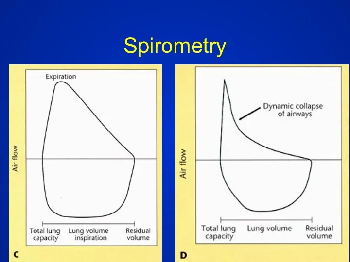 Spirometry