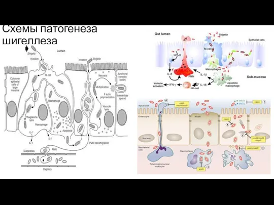 Схемы патогенеза шигеллеза