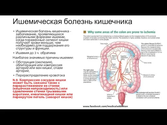 Ишемическая болезнь кишечника Ишемическая болезнь кишечника - заболевание, проявляющееся различными