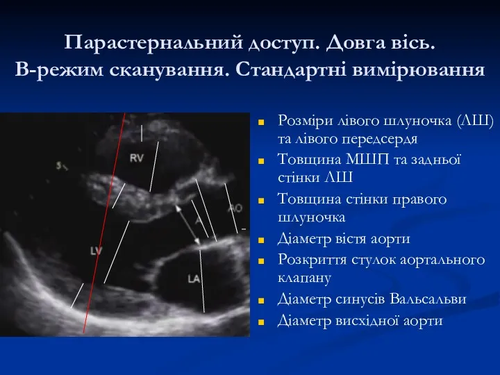 Розміри лівого шлуночка (ЛШ) та лівого передсердя Товщина МШП та