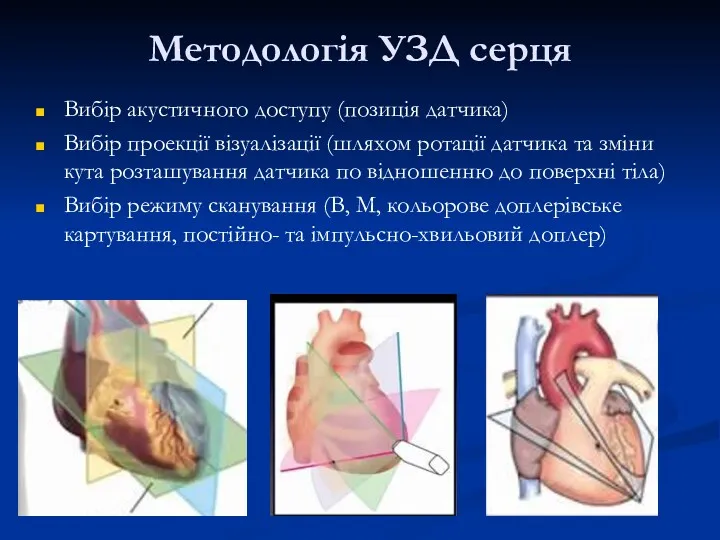 Вибір акустичного доступу (позиція датчика) Вибір проекції візуалізації (шляхом ротації