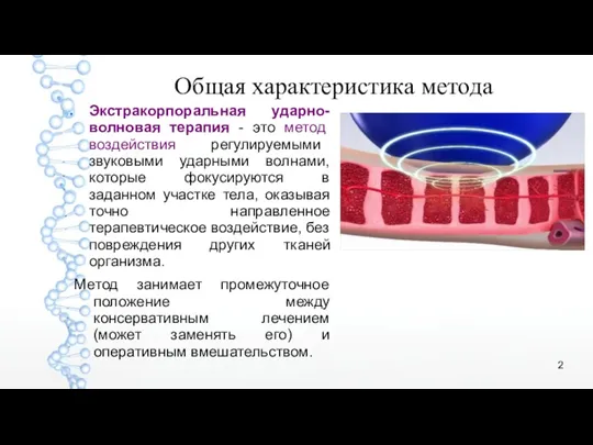 Общая характеристика метода Экстракорпоральная ударно-волновая терапия - это метод воздействия