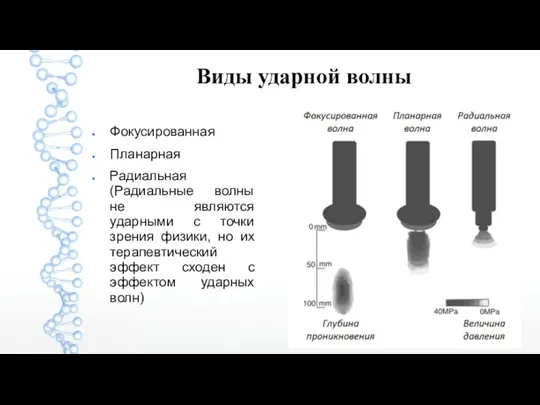 Виды ударной волны Фокусированная Планарная Радиальная (Радиальные волны не являются