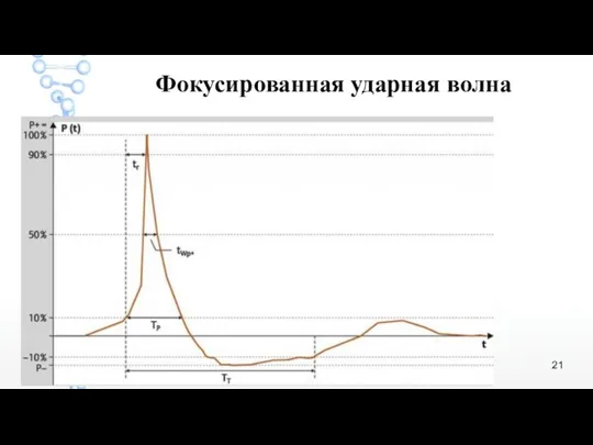 Фокусированная ударная волна