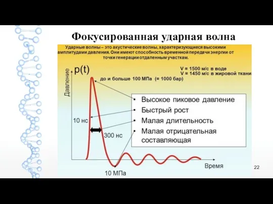 Фокусированная ударная волна