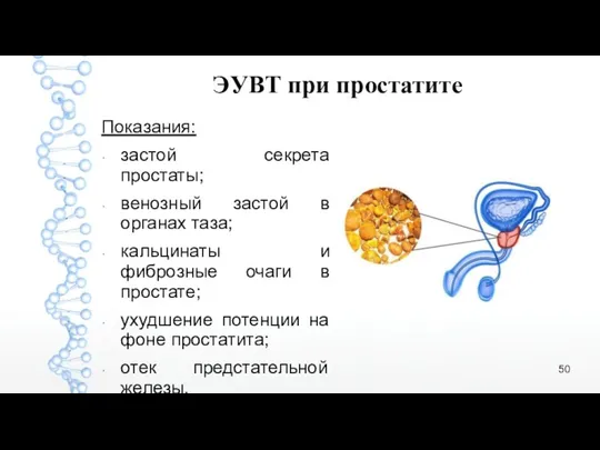 ЭУВТ при простатите Показания: застой секрета простаты; венозный застой в