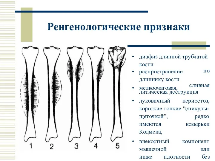 Ренгенологические признаки диафиз длинной трубчатой кости распространение длиннику кости мелкоочаговая,