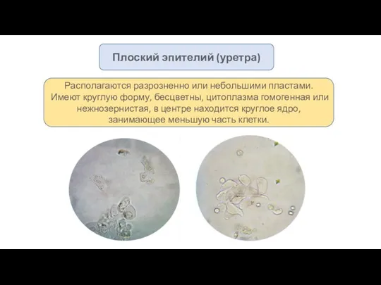 Плоский эпителий (уретра) Располагаются разрозненно или небольшими пластами. Имеют круглую