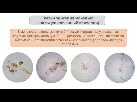 В моче могут иметь форму кубическую, неправильную округлую, круглую, четырехугольную,