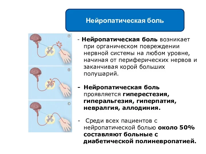 - Нейропатическая боль возникает при органическом повреждении нервной системы на любом уровне, начиная