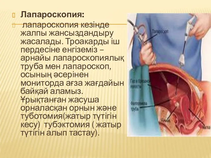 Лапароскопия: лапароскопия кезінде жалпы жансыздандыру жасалады. Троакарды іш пердесіне енгіземіз