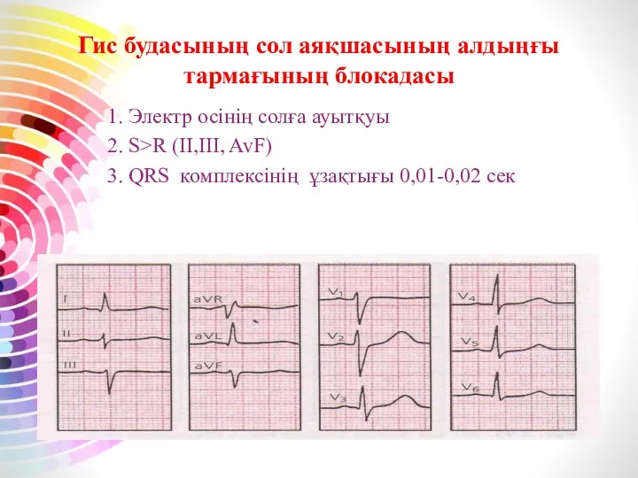 Гис будасының сол аяқшасының алдыңғы тармағының блокадасы 1. Электр осінің