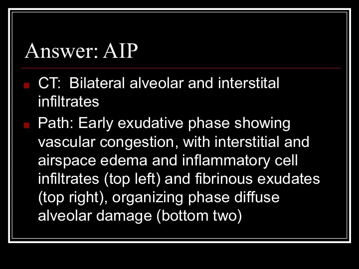 Answer: AIP CT: Bilateral alveolar and interstital infiltrates Path: Early