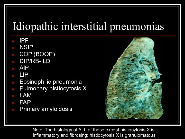 Idiopathic interstitial pneumonias IPF NSIP COP (BOOP) DIP/RB-ILD AIP LIP Eosinophilic pneumonia Pulmonary
