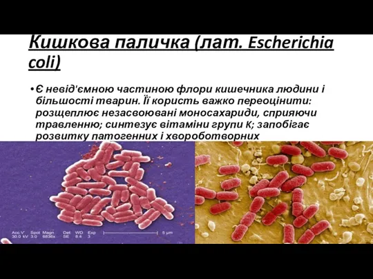Кишкова паличка (лат. Escherichia coli) Є невід'ємною частиною флори кишечника