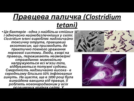Правцева паличка (Clostridium tetani) Ця бактерія - одна з найбільш