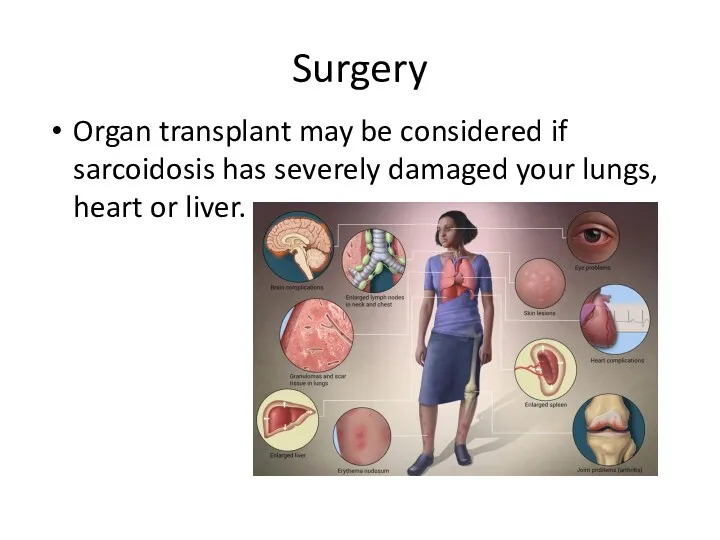 Surgery Organ transplant may be considered if sarcoidosis has severely damaged your lungs, heart or liver.