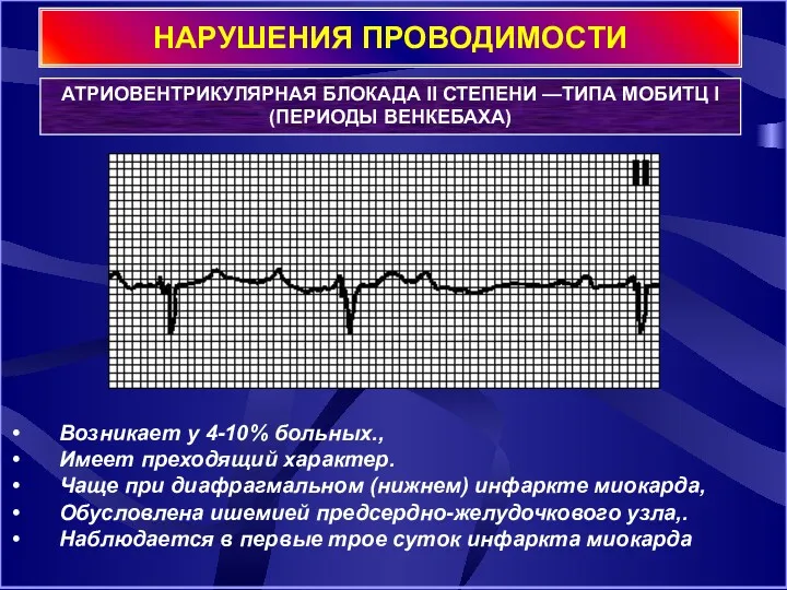 НАРУШЕНИЯ ПРОВОДИМОСТИ АТРИОВЕНТРИКУЛЯРНАЯ БЛОКАДА II СТЕПЕНИ —ТИПА МОБИТЦ I (ПЕРИОДЫ ВЕНКЕБАХА) Возникает у