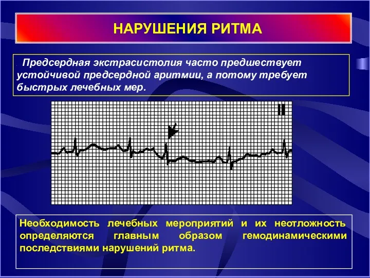 НАРУШЕНИЯ РИТМА Предсердная экстрасистолия часто предшествует устойчивой предсердной аритмии, а потому требует быстрых