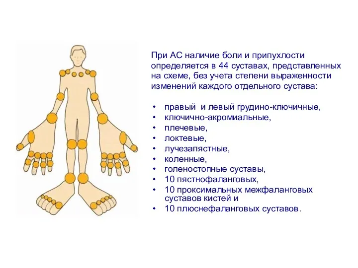 При АС наличие боли и припухлости определяется в 44 суставах,