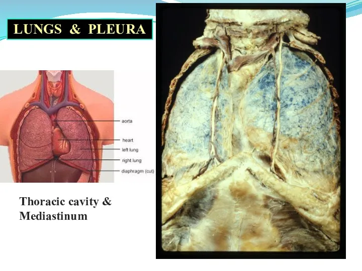 LUNGS & PLEURA Thoracic cavity & Mediastinum