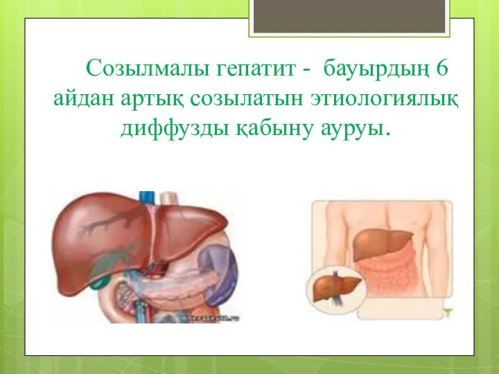 Созылмалы гепатит - бауырдың 6 айдан артық созылатын этиологиялық диффузды қабыну ауруы.