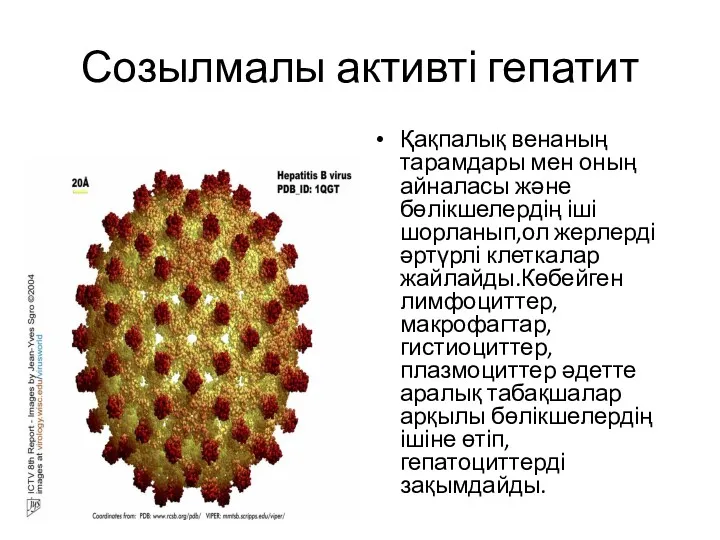 Созылмалы активті гепатит Қақпалық венаның тарамдары мен оның айналасы және