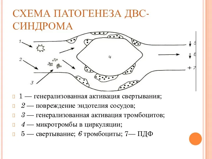 СХЕМА ПАТОГЕНЕЗА ДВС-СИНДРОМА 1 — генерализованная активация свертывания; 2 —