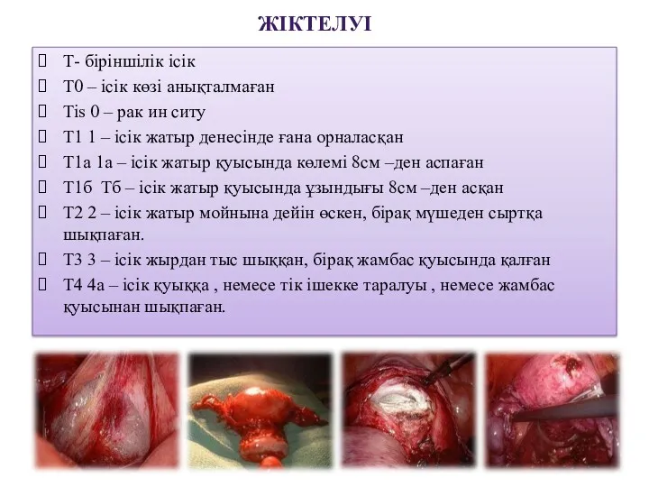 ЖІКТЕЛУІ Т- біріншілік ісік Т0 – ісік көзі анықталмаған Тis