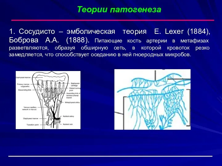 Теории патогенеза 1. Сосудисто – эмболическая теория E. Lexer (1884),