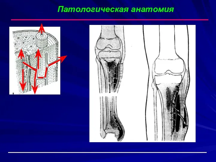 Патологическая анатомия