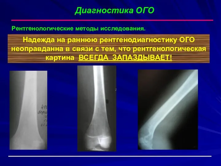 Диагностика ОГО Рентгенологические методы исследования. Надежда на раннюю рентгенодиагностику ОГО неоправданна в связи