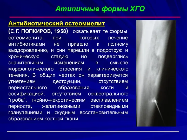 Антибиотический остеомиелит (С.Г. ПОПКИРОВ, 1958) охватывает те формы остеомиелита, при