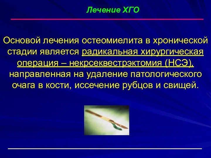 Лечение ХГО Основой лечения остеомиелита в хронической стадии является радикальная