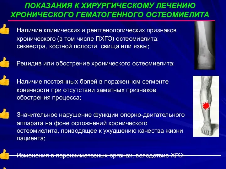 ПОКАЗАНИЯ К ХИРУРГИЧЕСКОМУ ЛЕЧЕНИЮ ХРОНИЧЕСКОГО ГЕМАТОГЕННОГО ОСТЕОМИЕЛИТА Наличие клинических и рентгенологических признаков хронического