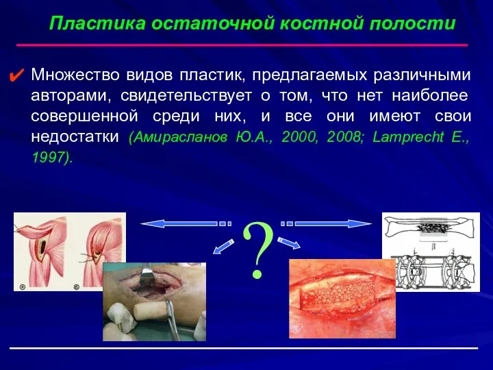 Множество видов пластик, предлагаемых различными авторами, свидетельствует о том, что