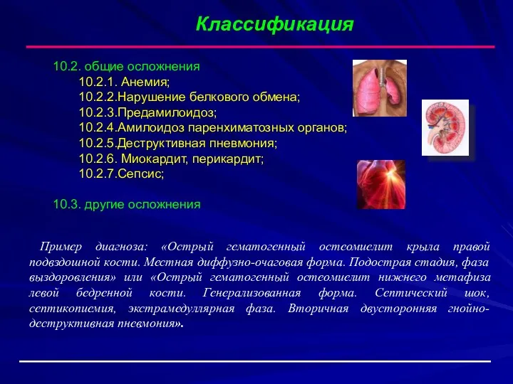 Классификация 10.2. общие осложнения 10.2.1. Анемия; 10.2.2.Нарушение белкового обмена; 10.2.3.Предамилоидоз; 10.2.4.Амилоидоз паренхиматозных органов;