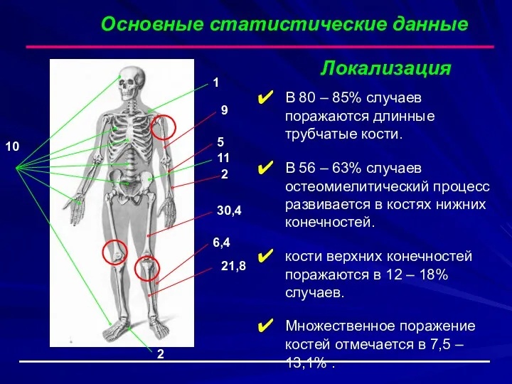 Основные статистические данные Локализация В 80 – 85% случаев поражаются длинные трубчатые кости.