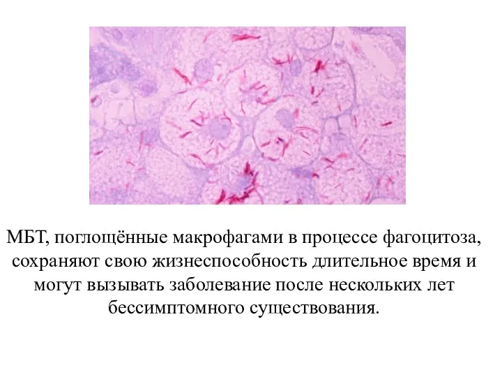 МБТ, поглощённые макрофагами в процессе фагоцитоза, сохраняют свою жизнеспособность длительное