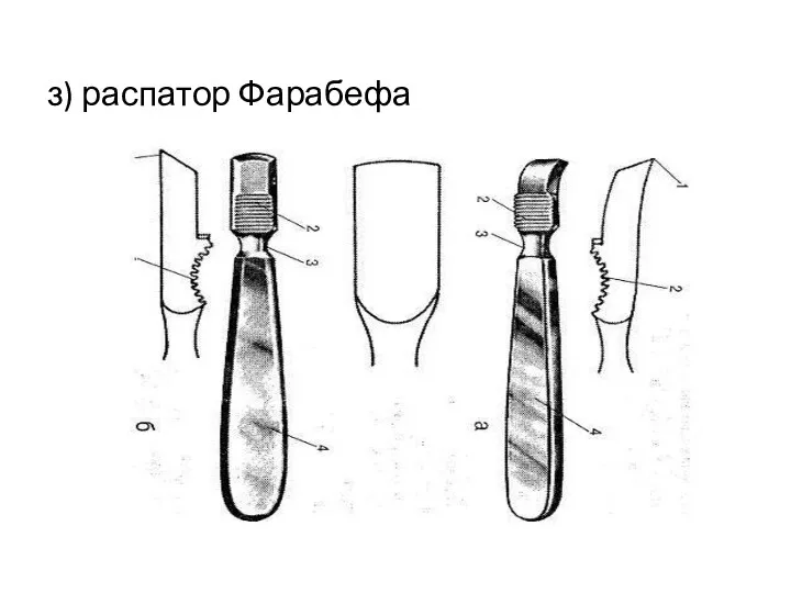 з) распатор Фарабефа